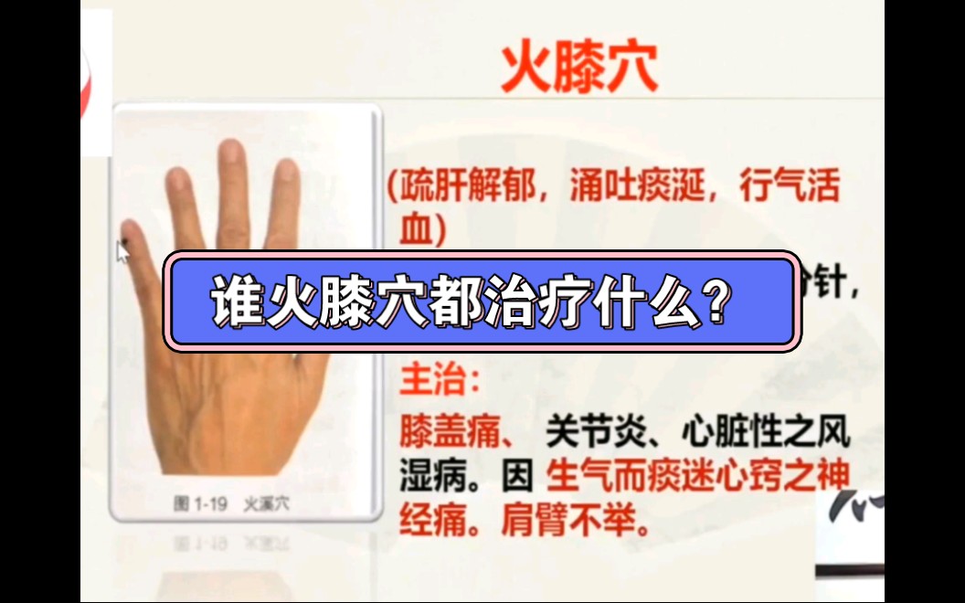 董氏奇穴～火膝穴主治膝盖痛,关节炎,心脏性之风湿病,因生气而痰迷