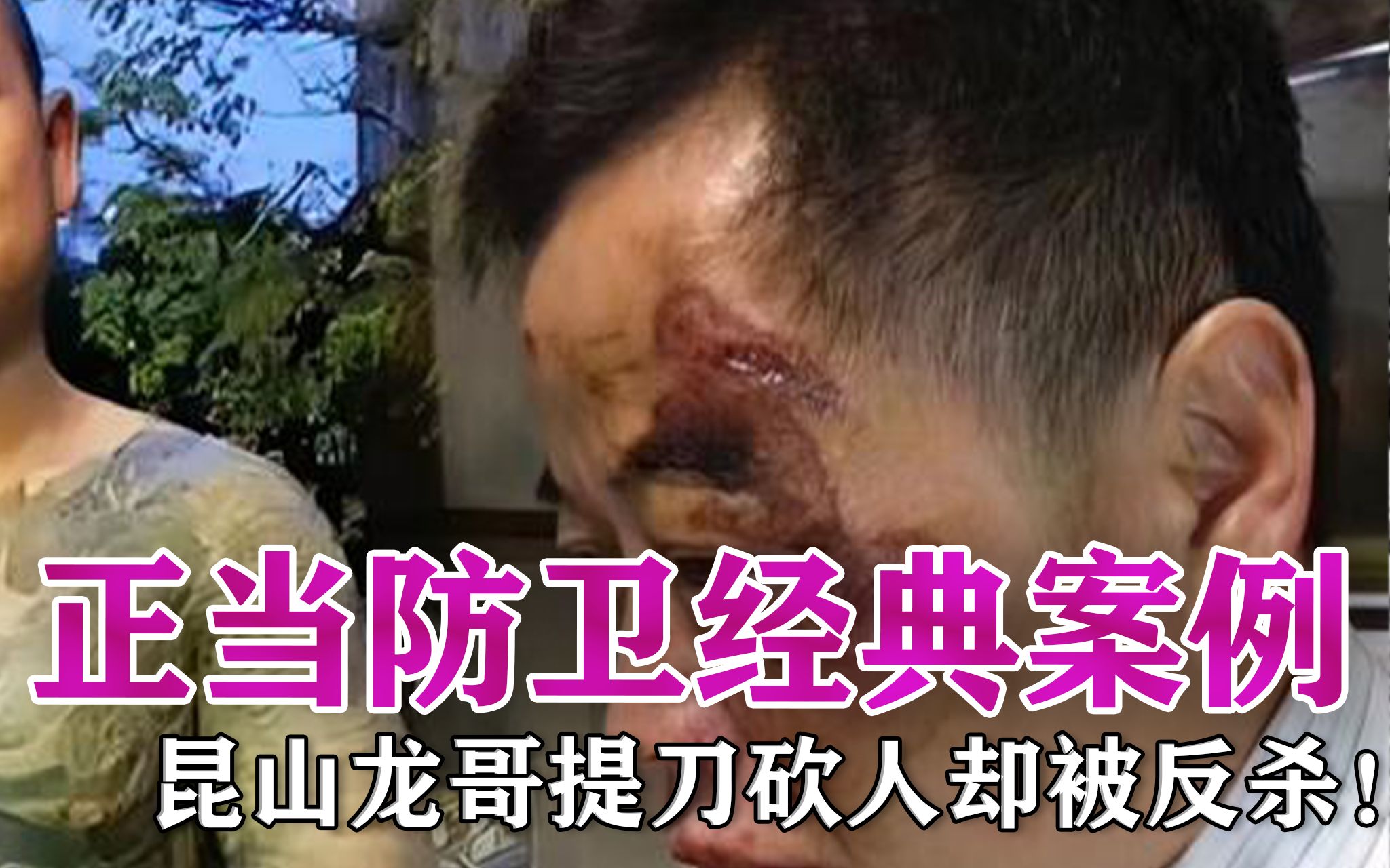 正当防卫经典案例:昆山龙哥嚣张跋扈,却被老实人反杀!