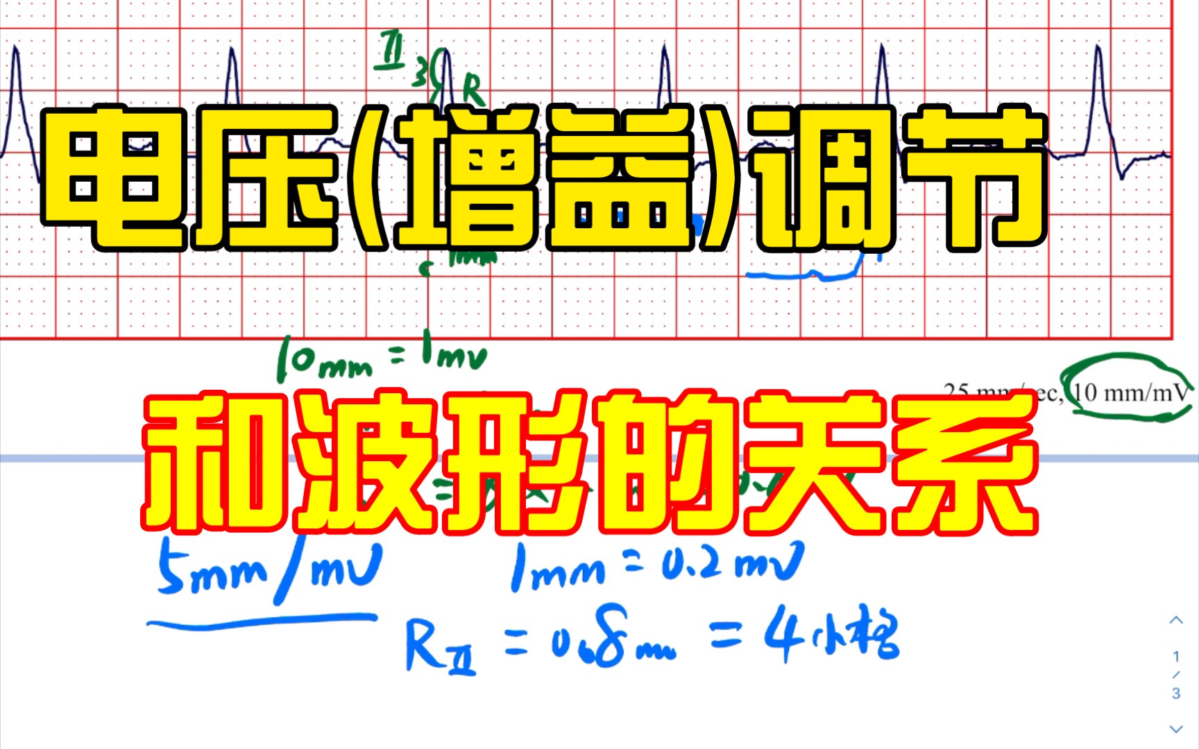 心电图电压(增益)调节和波形的关系哔哩哔哩bilibili