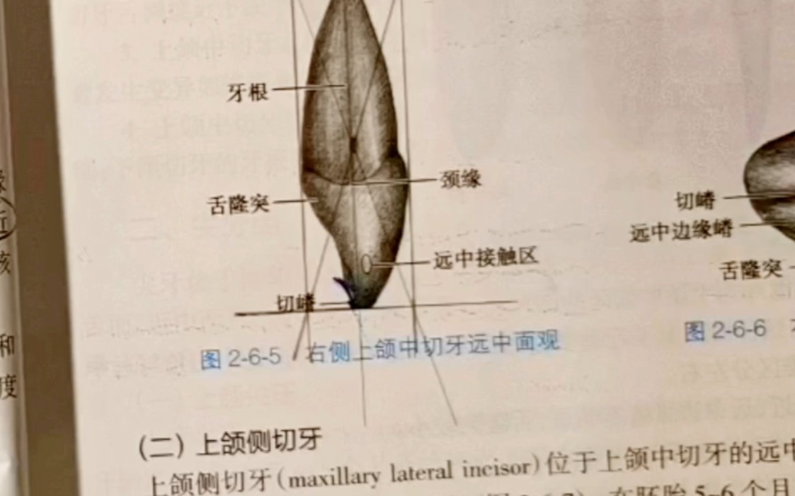 上颌中切牙切嵴位于牙体长轴的唇侧还是舌侧?