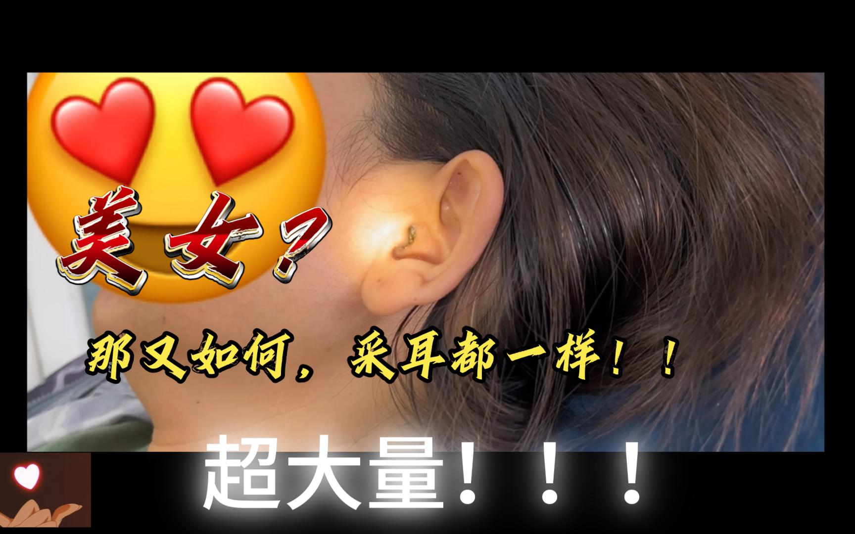 【解压视频】沉浸式采耳,美女也不能避免,饭量很大嘛!!!哔哩哔哩bilibili