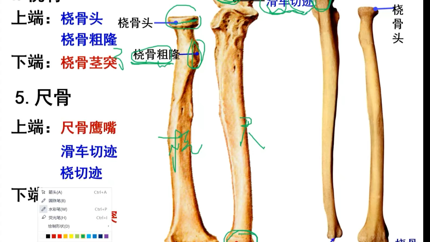 左桡骨头图片