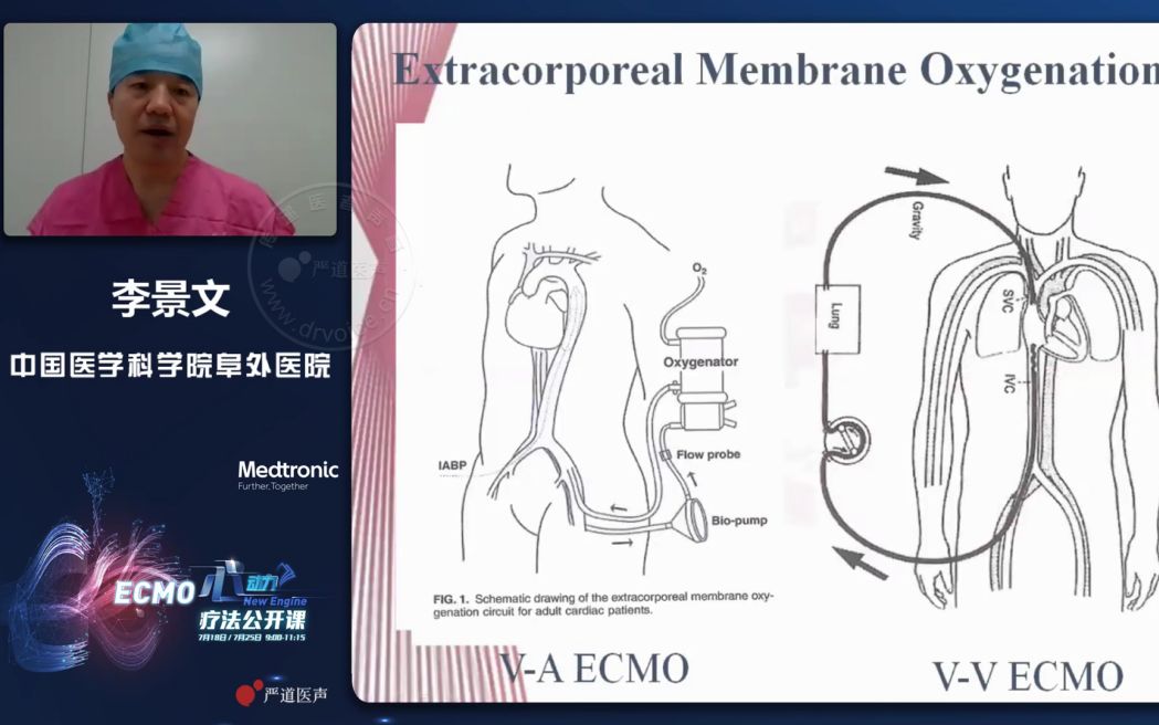 [图]【李景文】VA ECMO物品准备及置管