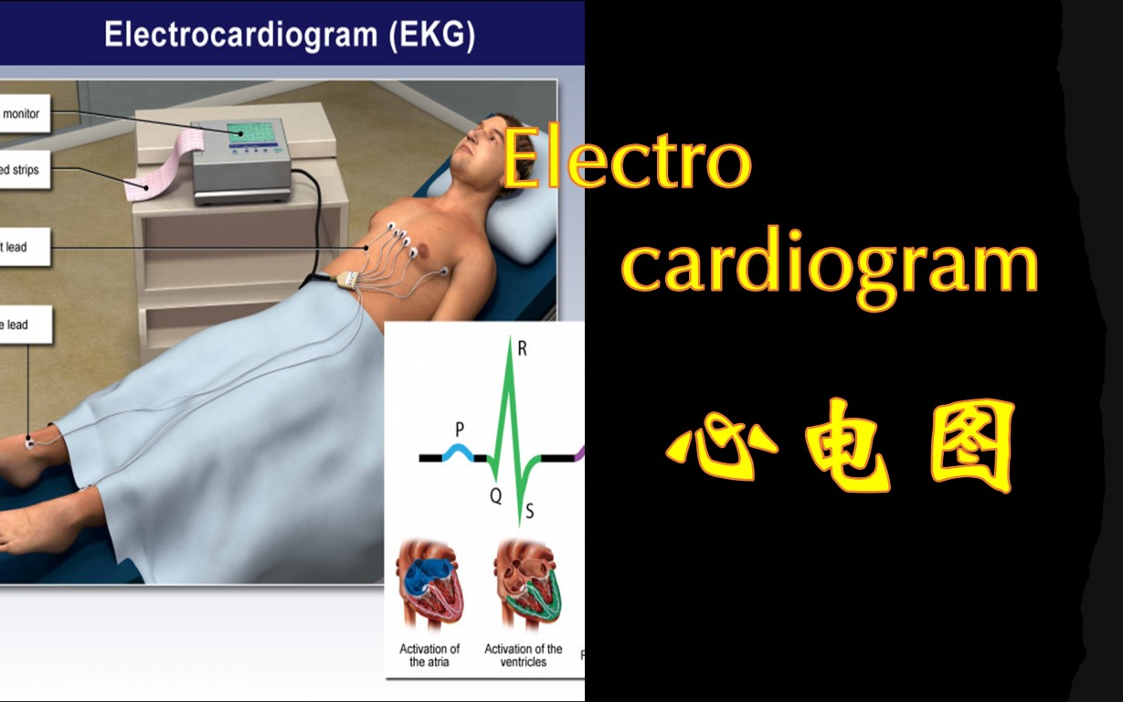 趣味心电图 | Mastering EKGs哔哩哔哩bilibili