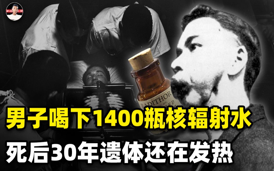 [图]一男子喝下1400瓶核辐射水，身体瓦解，下葬几十年尸体还在发热