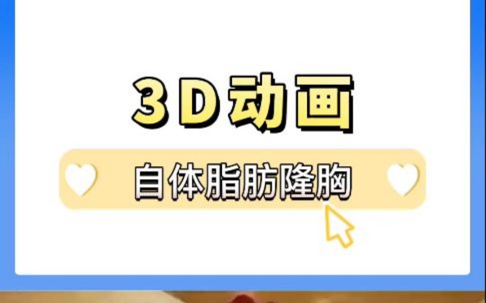 3D动画演示:自体脂肪隆胸过程!哔哩哔哩bilibili