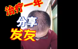 Download Video: 发友治疗脱发一年效果，差不多可以代表大部分人的治疗效果。