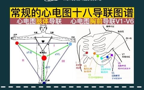 除了常规的心电图十二导联外,还有升级版的十八导联哦哔哩哔哩bilibili