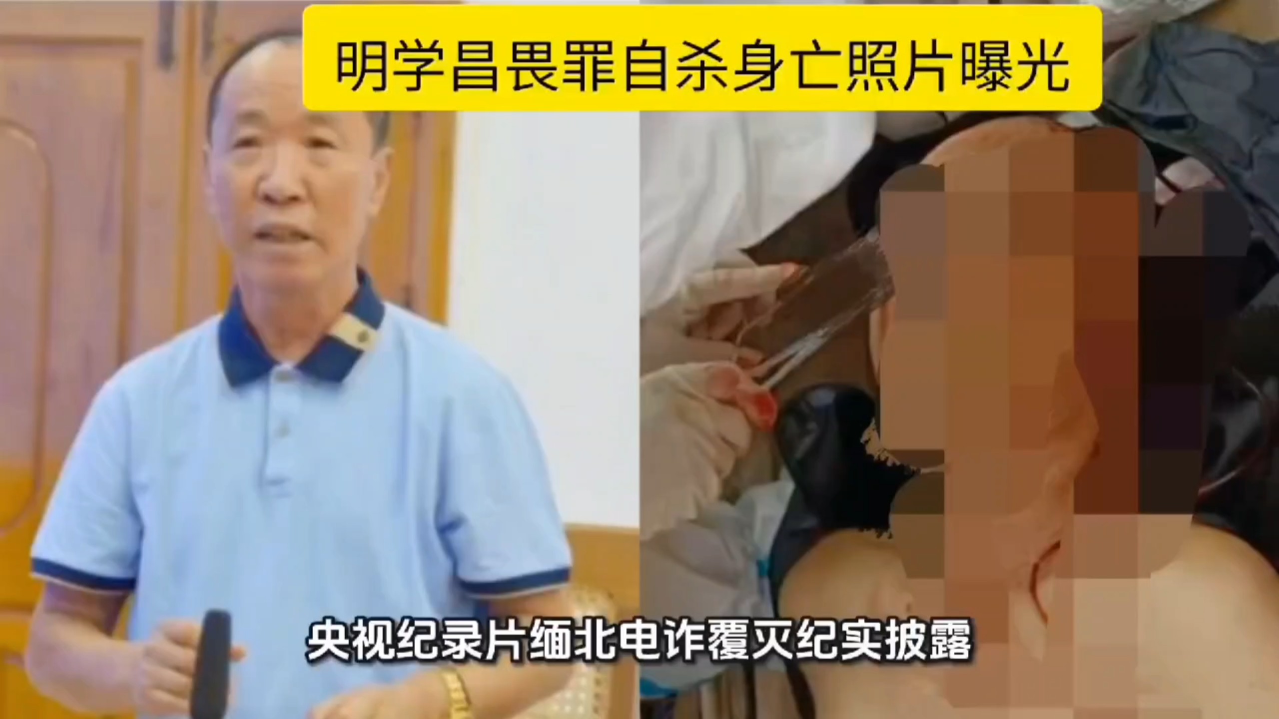 明学昌畏罪自杀身亡照片曝光，缅北明家彻底覆灭