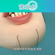 Download Video: 常见的垫下巴整形手术有几种？