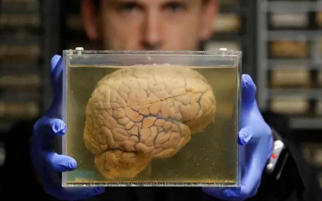 首次!科学家培育出人造大脑让肌肉抖动,苏大强的病有望治疗!