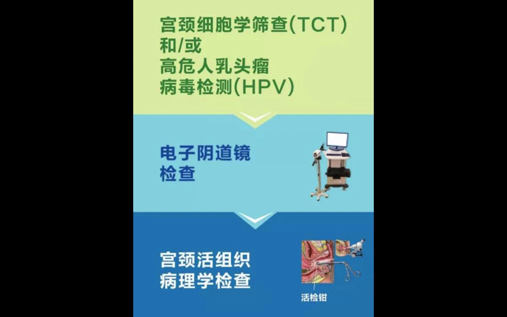 宮頸細胞學篩查(tct)和高危人乳頭瘤病毒檢測(hpv) 上海都市醫院