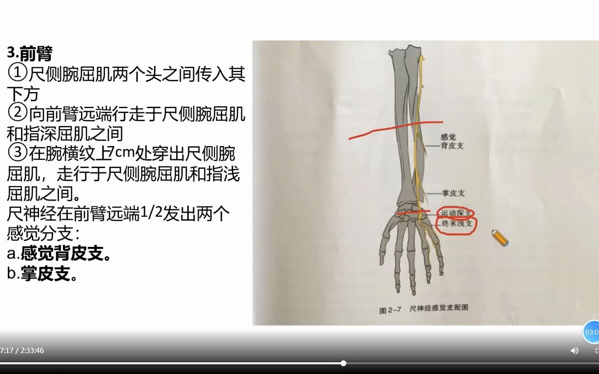 尺神经与guyon管空间位置关系解析