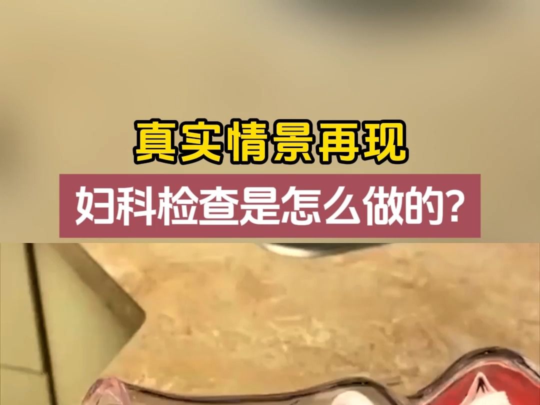 妇科检查是怎么做的呢?哔哩哔哩bilibili