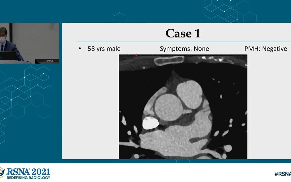 (心脏CTA病例复习3)Mentored Cardiac CT Angiography Case Review Part III  RSNA 2021哔哩哔哩bilibili