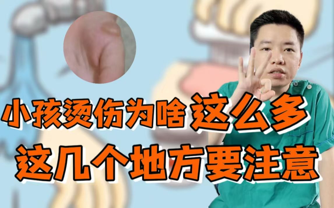 孩子被烫伤了怎么办,这三个地方可别再带孩子去了哔哩哔哩bilibili