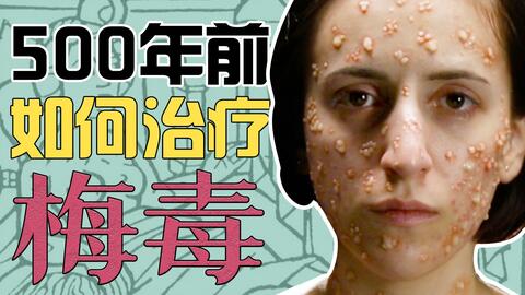 水银治 花柳 梅毒性病 古代医疗 脑残还是智慧 哔哩哔哩 水银治 花柳 梅毒性病 古代医疗 脑残还是智慧 哔哩哔哩