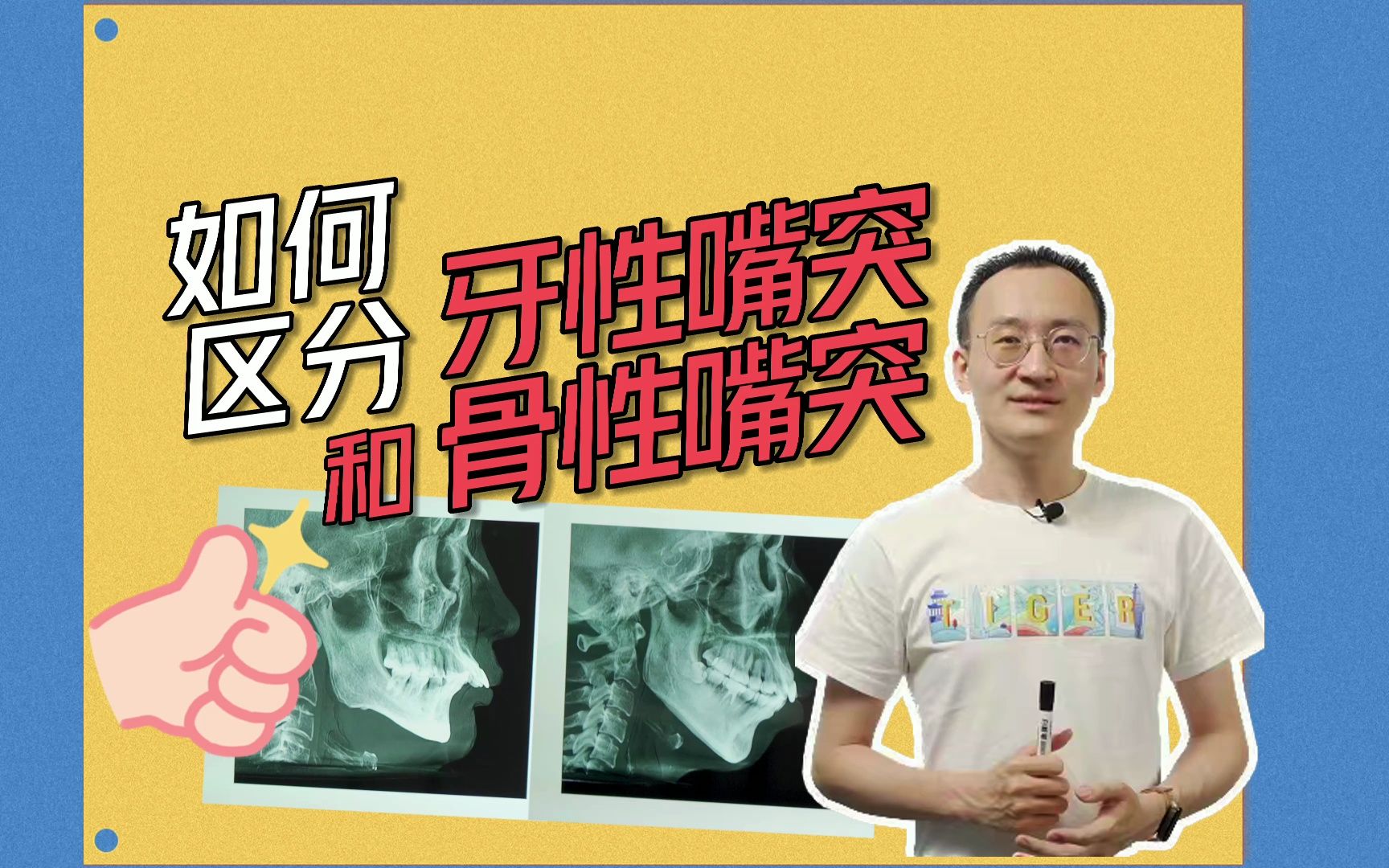 如何区分牙性嘴突和骨性嘴突哔哩哔哩bilibili