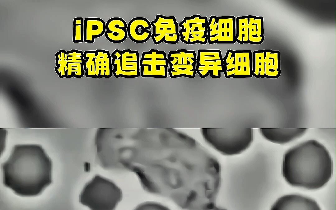 iPSC免疫细胞,精确追击变异细胞#iPSC细胞#免疫细胞#健康哔哩哔哩bilibili