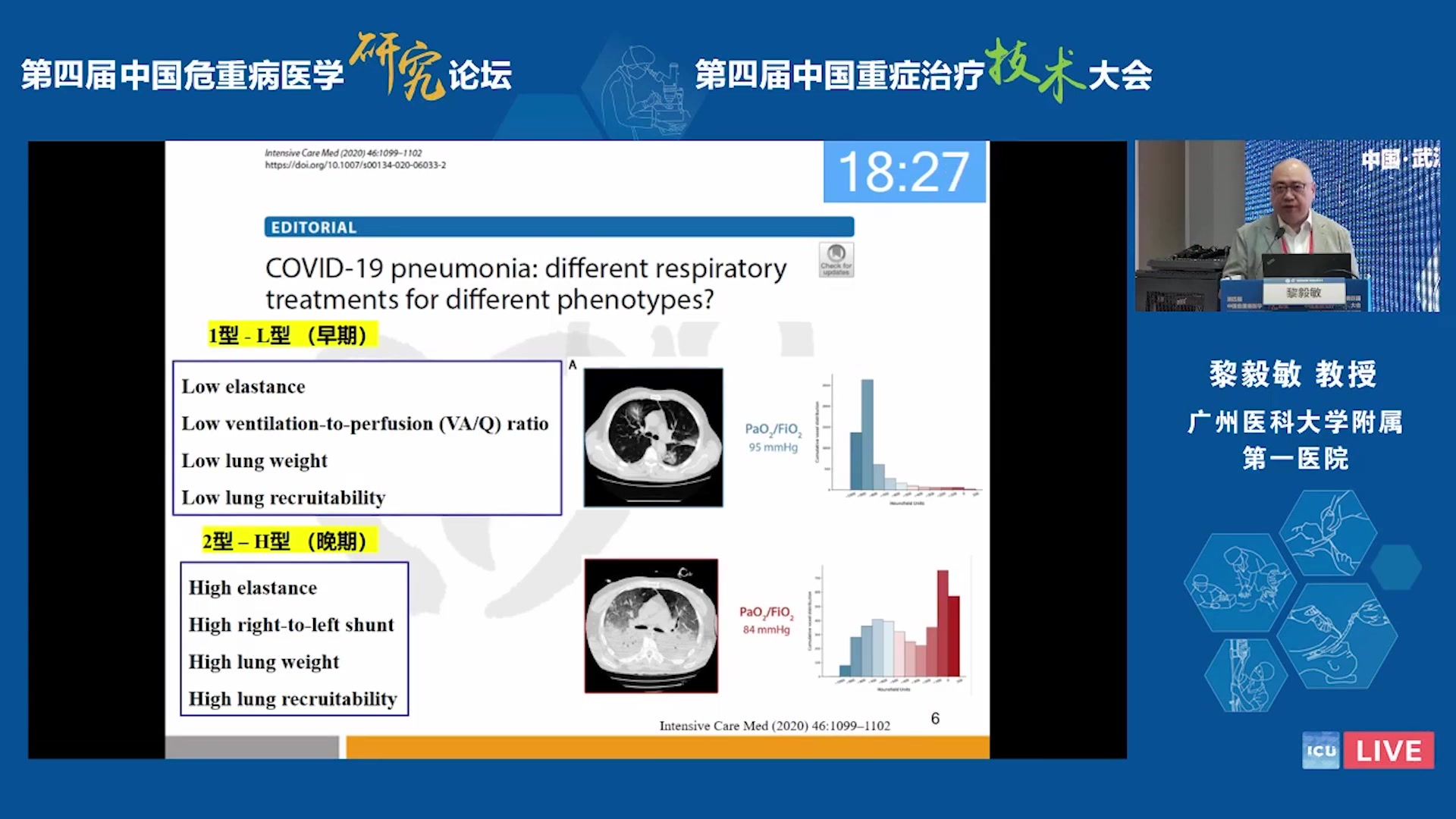 肺损伤的病理生理学基础 黎毅敏:国家呼吸医学中心哔哩哔哩bilibili