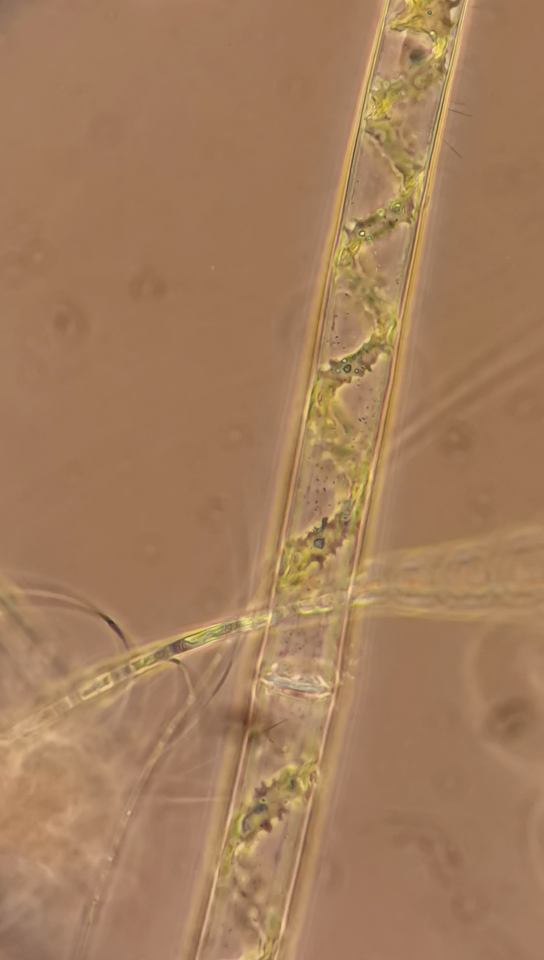 水绵独特的螺旋型叶绿体和活跃的细胞器