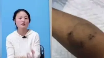 Tải video: 上海3岁幼童受虐致死案，孩子爸爸曾要求撤诉，称不要尸检尽快安葬