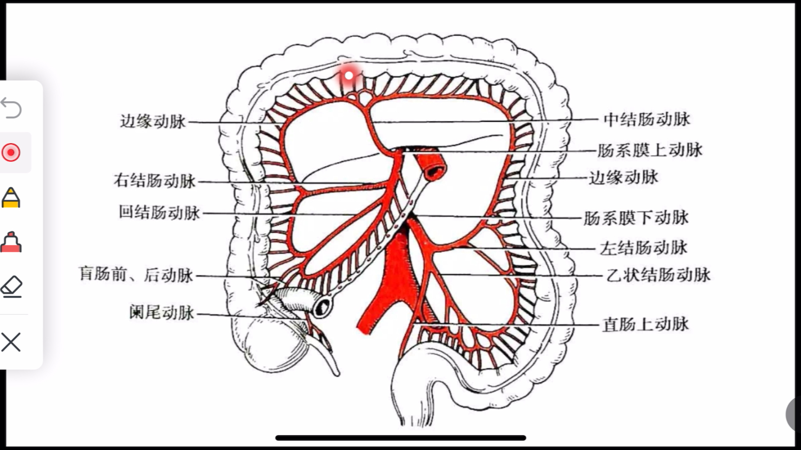右半结肠血管解剖图图片