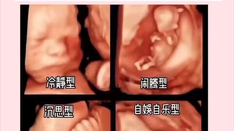 不一样的胎动 你家胎宝宝是哪种类型的 胎动有早有晚 你是几周感受到胎动的 胎儿 胎动 孕期 好孕 哔哩哔哩