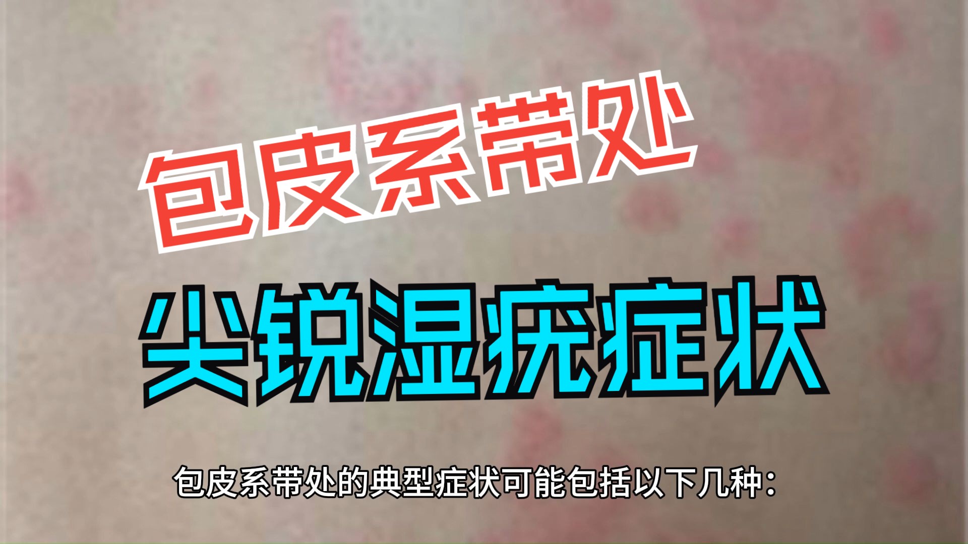 【尖锐湿疣科普】包皮系带处尖锐湿疣症状