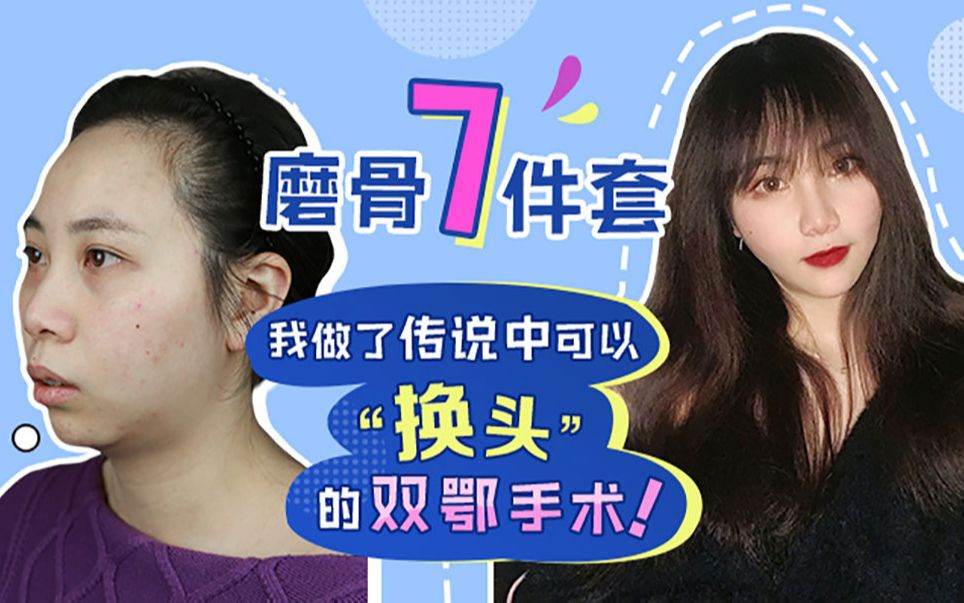 磨骨7件套?我做了传说中可以“换头”的双鄂手术!哔哩哔哩bilibili