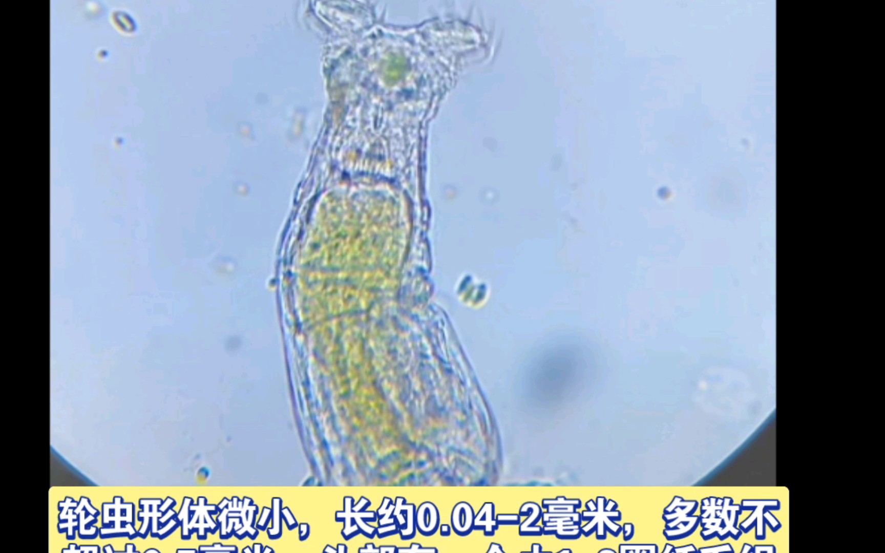 轮虫显微镜下图片图片