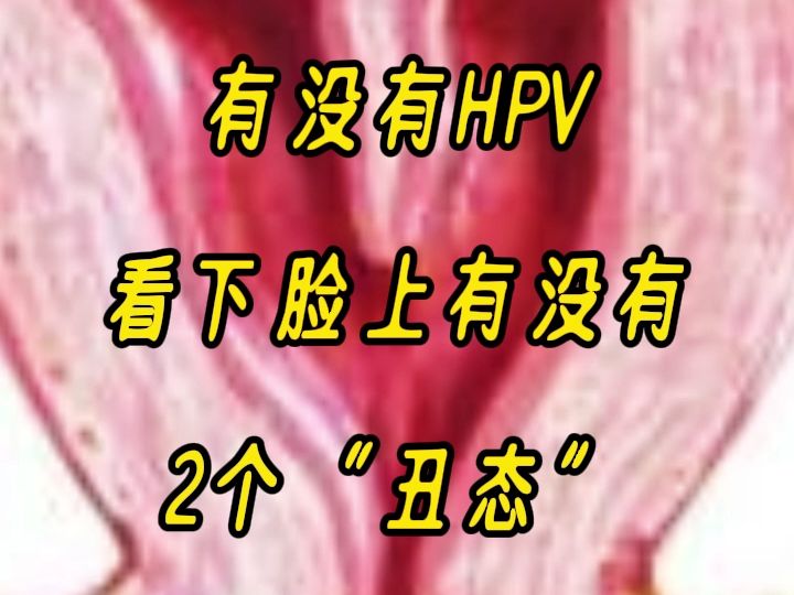 感染hpv红色丘疹图片图片