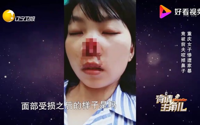 [图]【残忍】女子被前夫咬掉鼻子家暴吞进肚子里，观众都看不下去