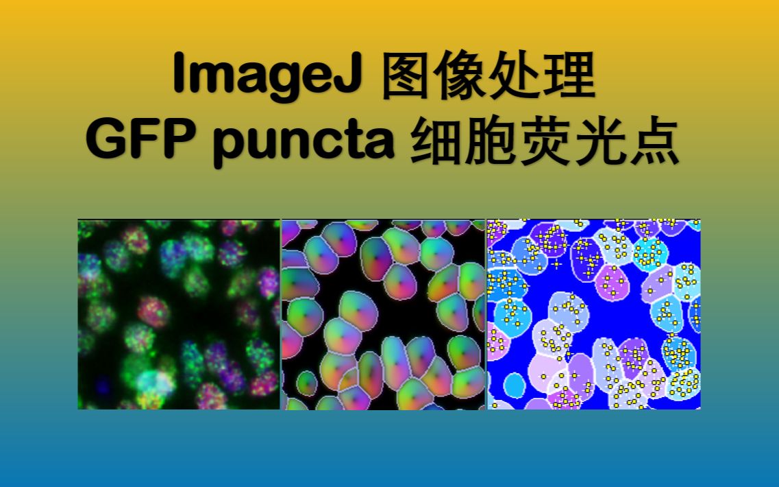 『超实用』ImageJ/Python图像处理  GFP puncta细胞荧光点批量分析与可视化哔哩哔哩bilibili