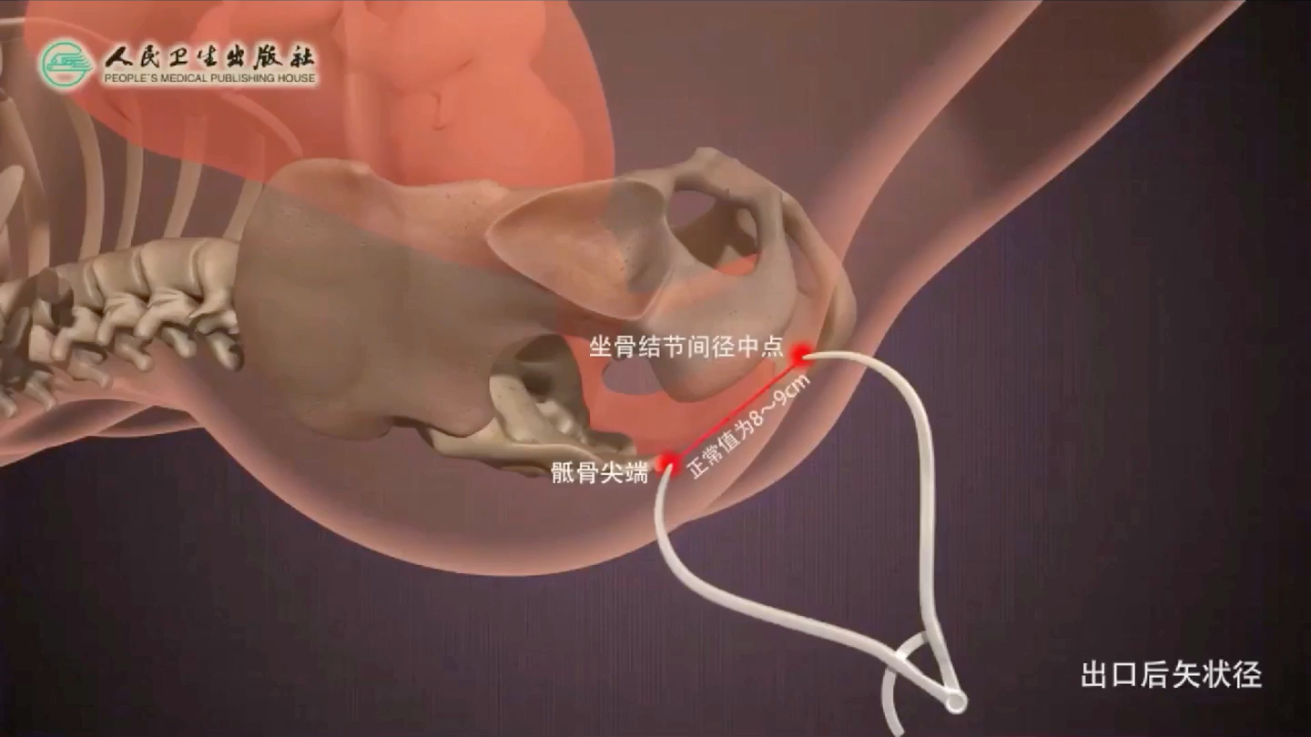 骨盆内测量