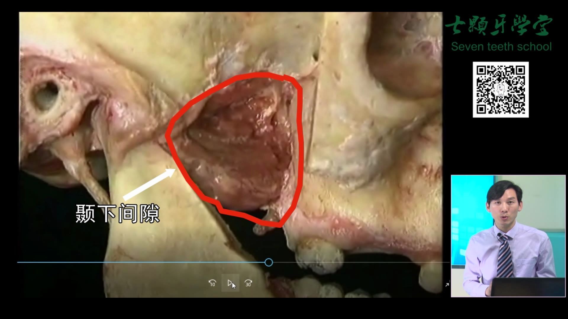 [图]颞下颌间隙——口腔解剖生理学