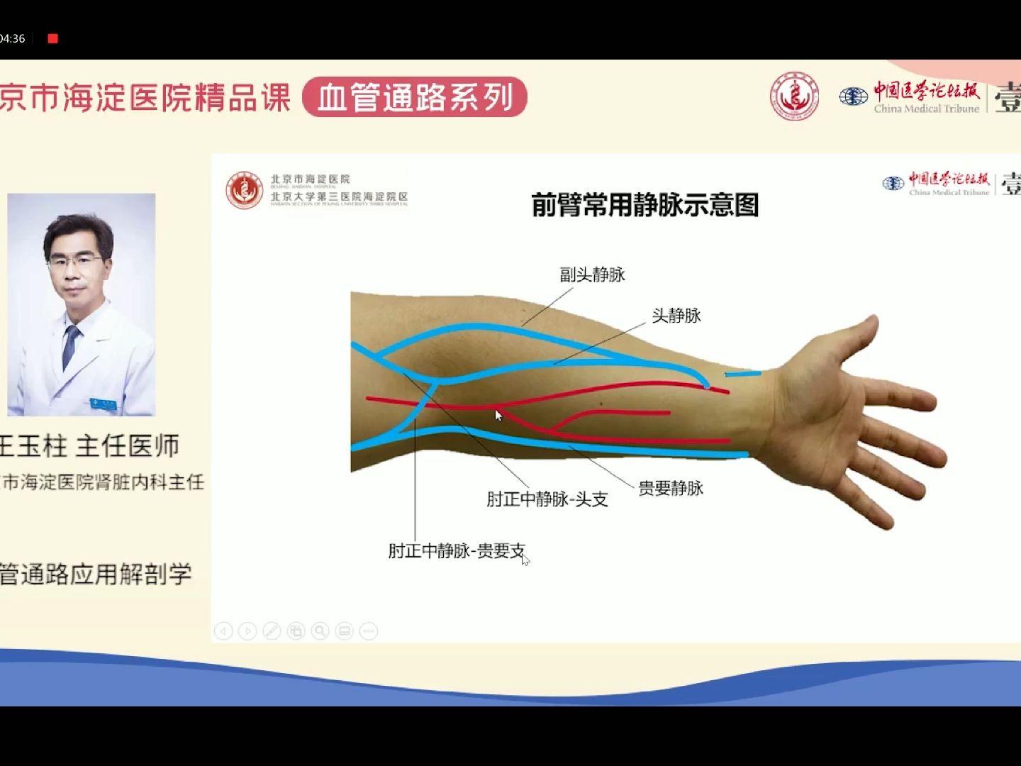 Day2 王玉柱:血液透析血管通路应用解剖学哔哩哔哩bilibili