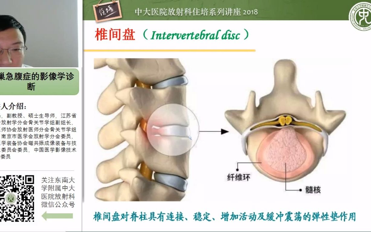 椎间盘病变的影像分型及评价中大靳激扬哔哩哔哩bilibili