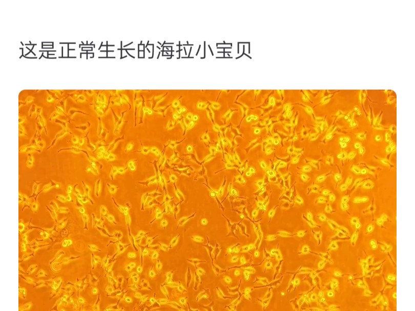 如果永生人类细胞「海拉细胞」泄露了会有危险吗?哔哩哔哩bilibili