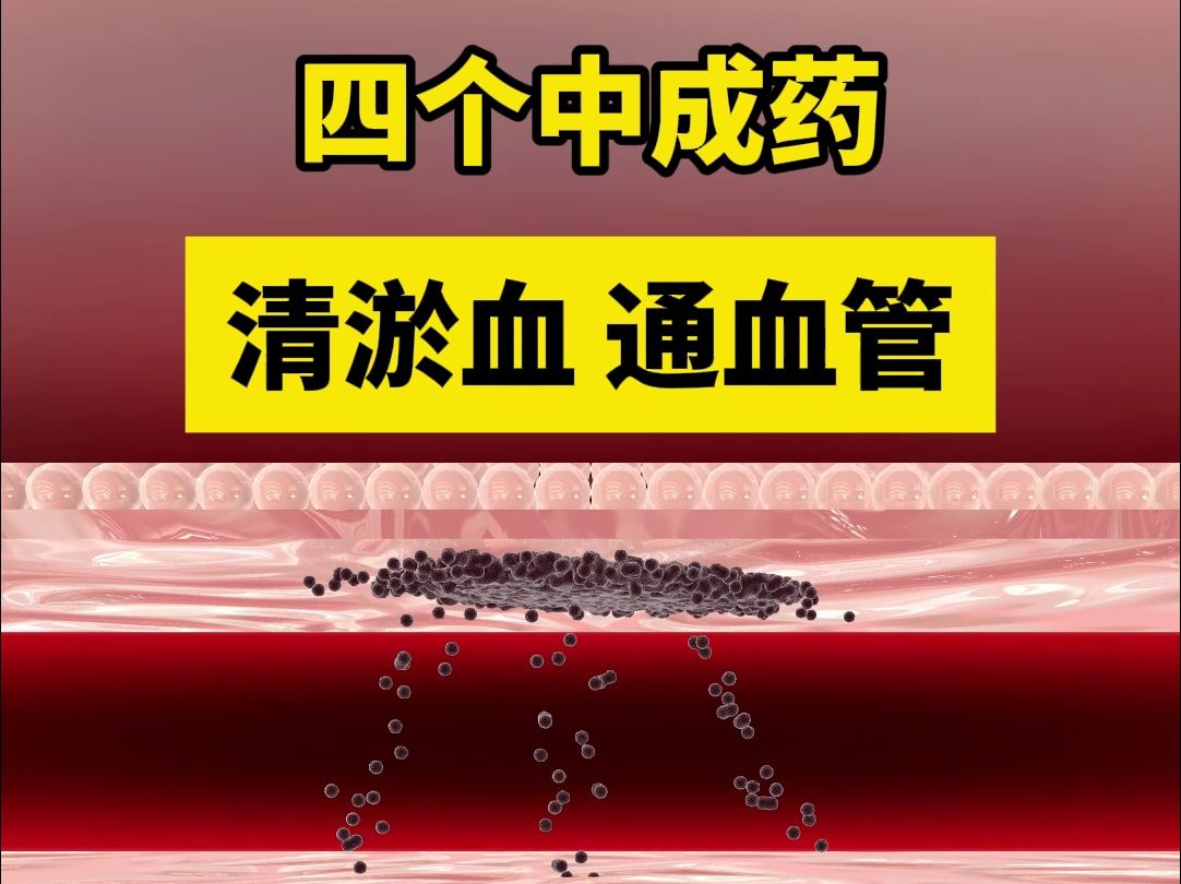 张问渠教授:四个中成药, 清淤血通血管,有脑梗的朋友收藏好哔哩哔哩bilibili