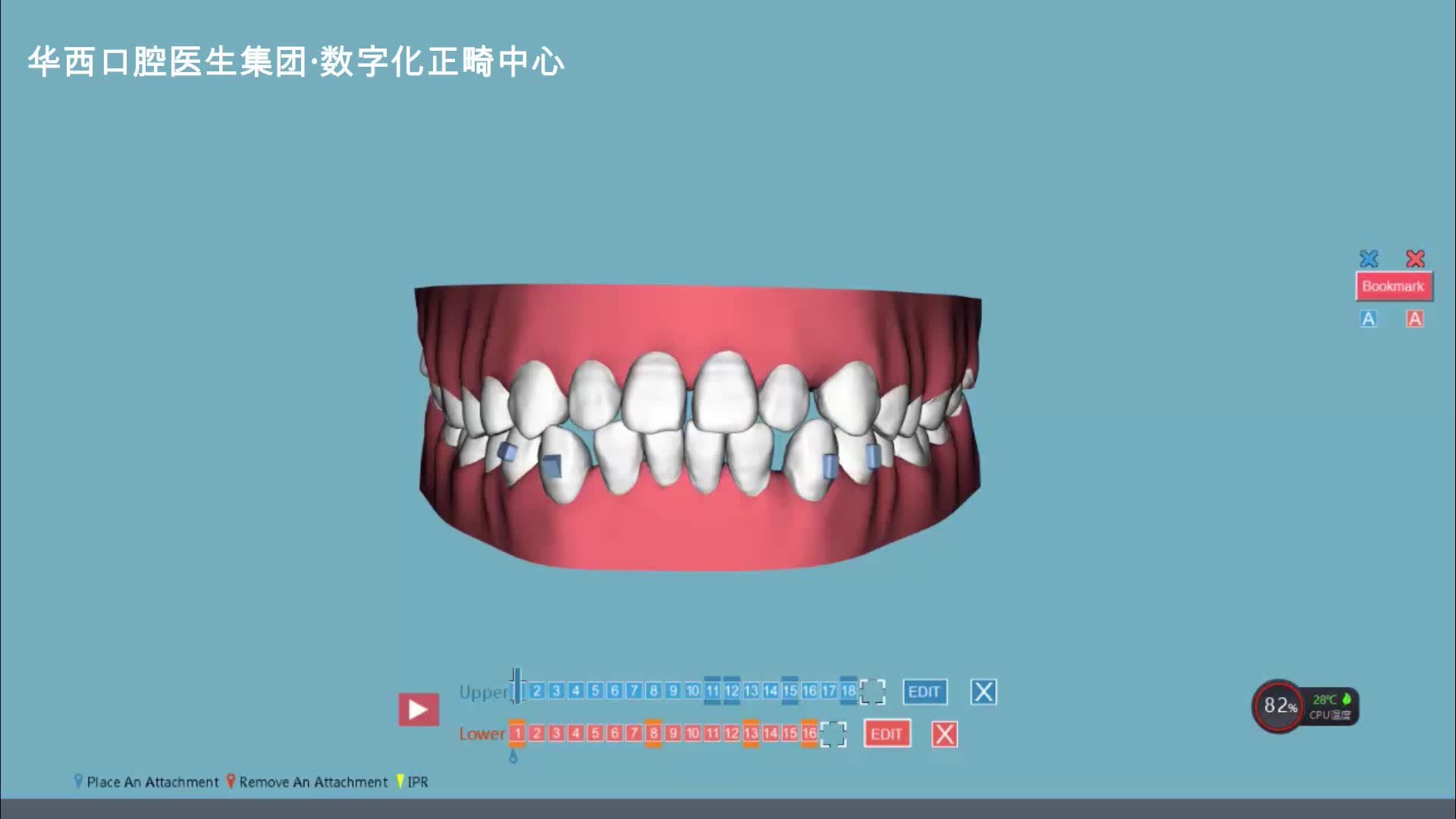 牙齿方案可视化华西口腔医生集团哔哩哔哩bilibili