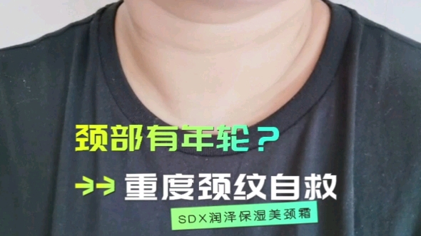 重度颈纹患者的自救日记—sdx美颈霜开箱测评哔哩哔哩bilibili