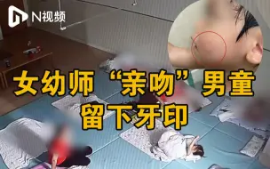 Download Video: 早教机构回应幼童被幼师亲吻致脸颊红肿有牙印：涉事老师已被停职