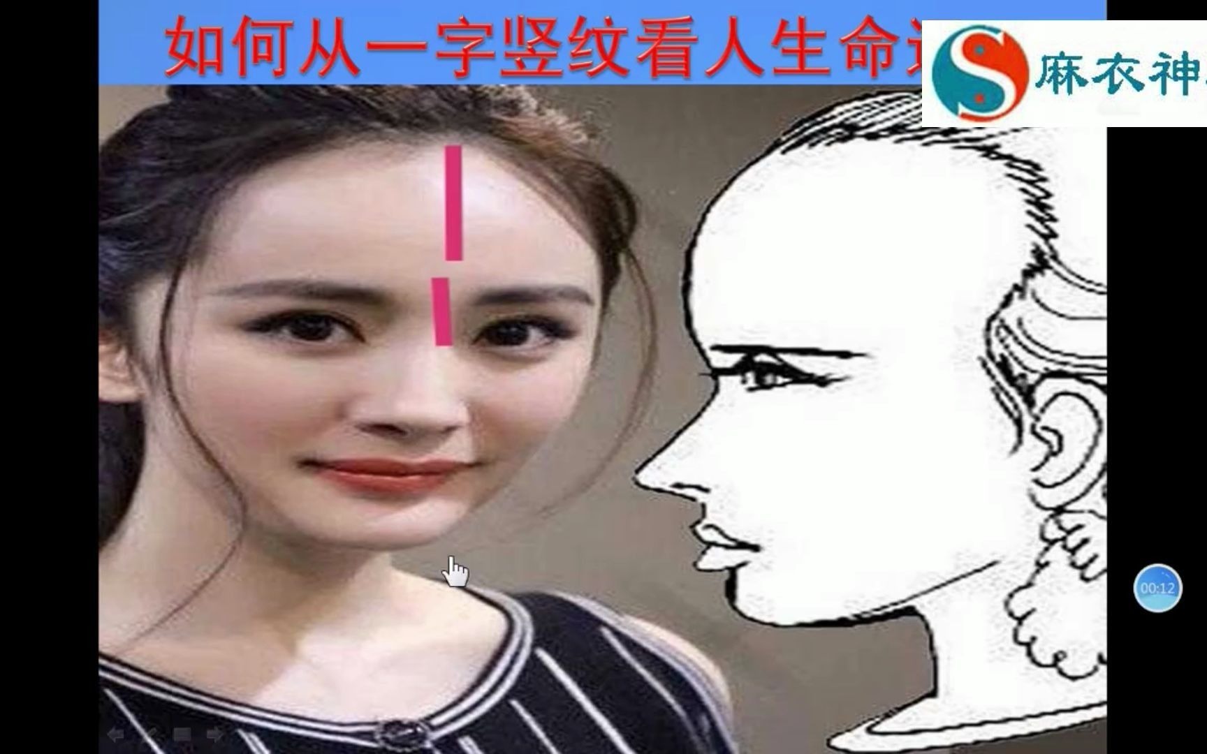 [图]如何从你脸上一字竖纹看人生命运呢？麻衣相师：上下悟透早知道！