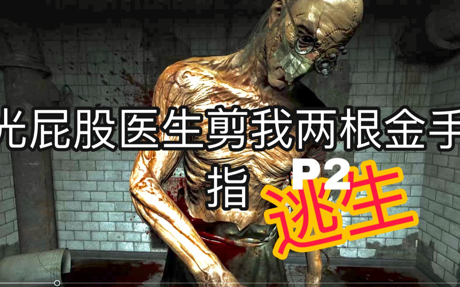 为了找到马丁神父被光屁股医生剪了两根金手指!