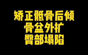 Download Video: 【体态矫正】怎样矫正骶骨后倾、骨盆外扩、臀部塌陷？