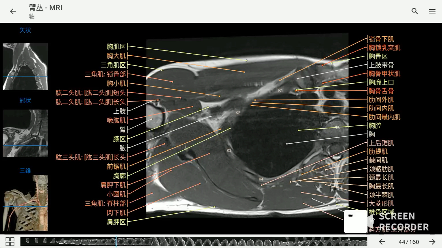 [图]影像解剖图谱神器 医学影像学必备 e-anatomy中文最新版 臂丛MRI