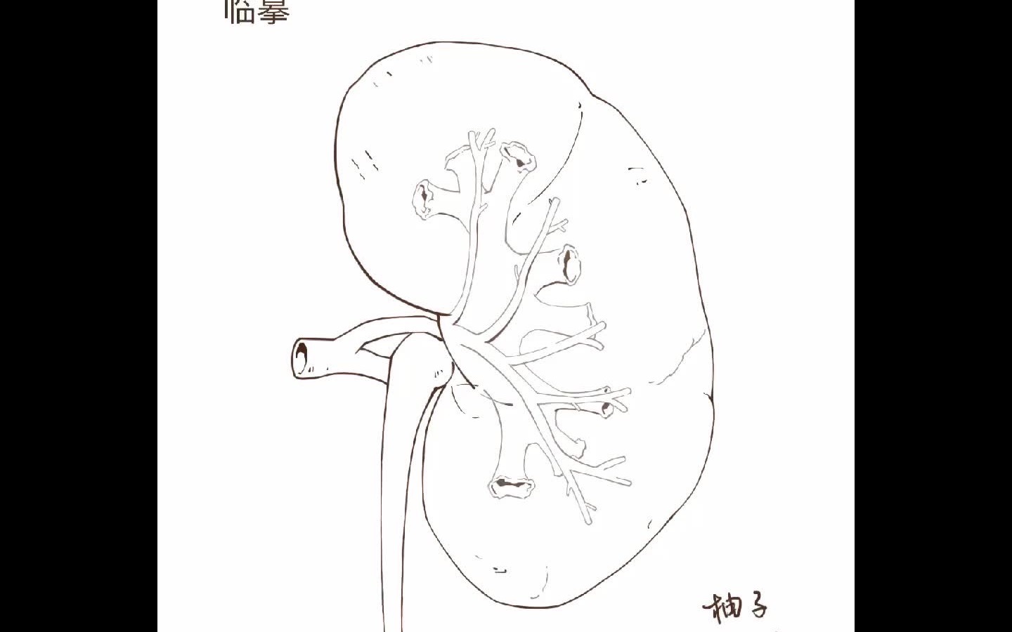 临摹丨医学插画(原图来自一目可视)procreate哔哩哔哩bilibili