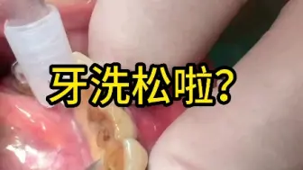 Tải video: 牙齿松了跟洗牙有关吗？