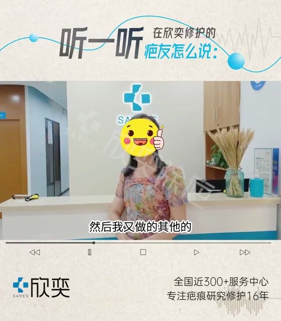 欣奕除疤 用实力和服务打动顾客哔哩哔哩bilibili